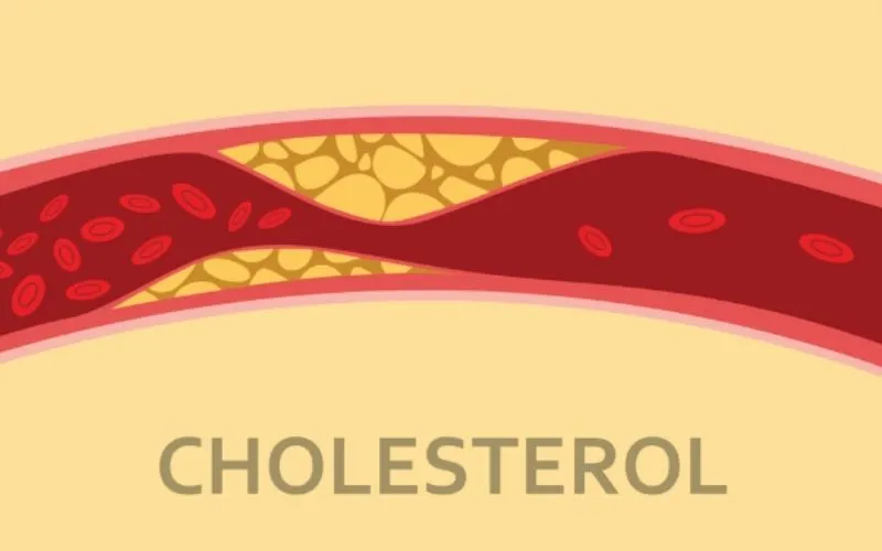 Chế độ ăn low fat là gì? Có nên áp dụng không?